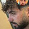 جراحی بینی ۳۱ میلیون