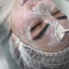 آفر ویژه به مدت ۱۰ روز فشیال تخصصی و کربوکسی تراپی صورت