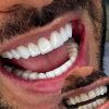 کامپوزیت دندان با برندهای اصل هر فک از ۲۰م
