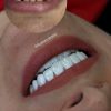 جشنواره مهرگان دندانپزشکی زیبایی و درمانی دکتر سنایی